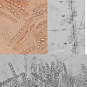Microscopy