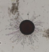 Sawadaea tulasnei