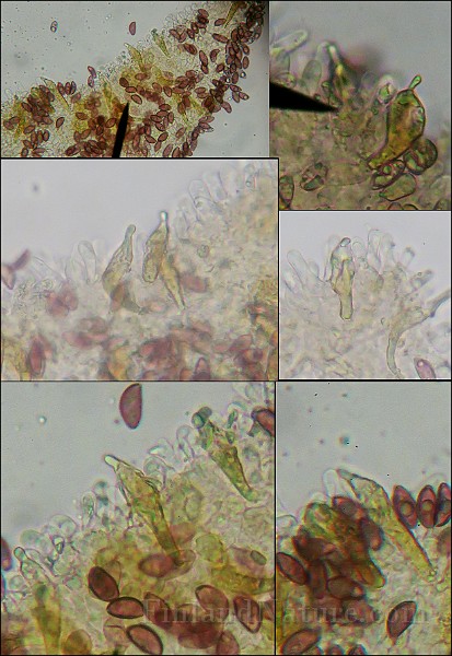 xcheilocystidia.jpg