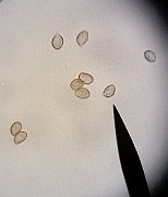 Spores